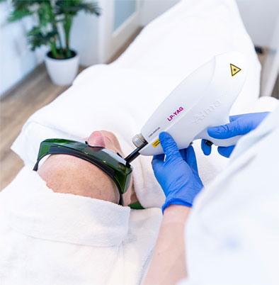 Fractional laser